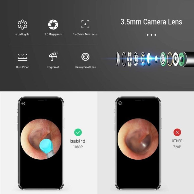 گوش پاک کن هوشمند bebird M9 Pro شیائومی
