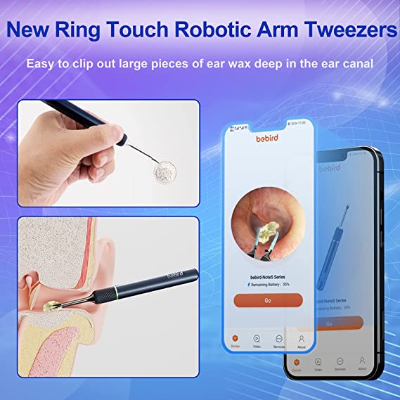 گوش پاککن هوشمند شیائومی مدل Bebird Note 5 Pro