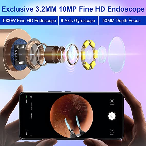 گوش پاککن هوشمند شیائومی مدل Bebird Note 5 Pro