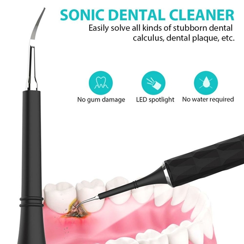 گوشپاککن هوشمند شیائومی مدل Bebird Note 5