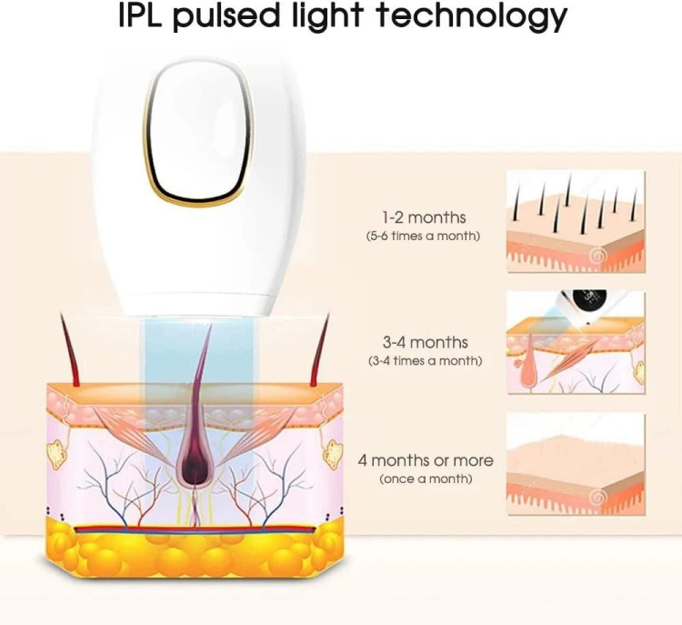 دستگاه لیزر IPL خانگی حذف موهای زائد 500000 شات، نور پالسی با لامپ زنون
